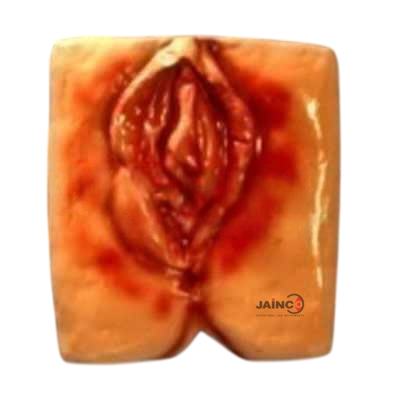 Injury in Cutous Hymen Cribriform Model